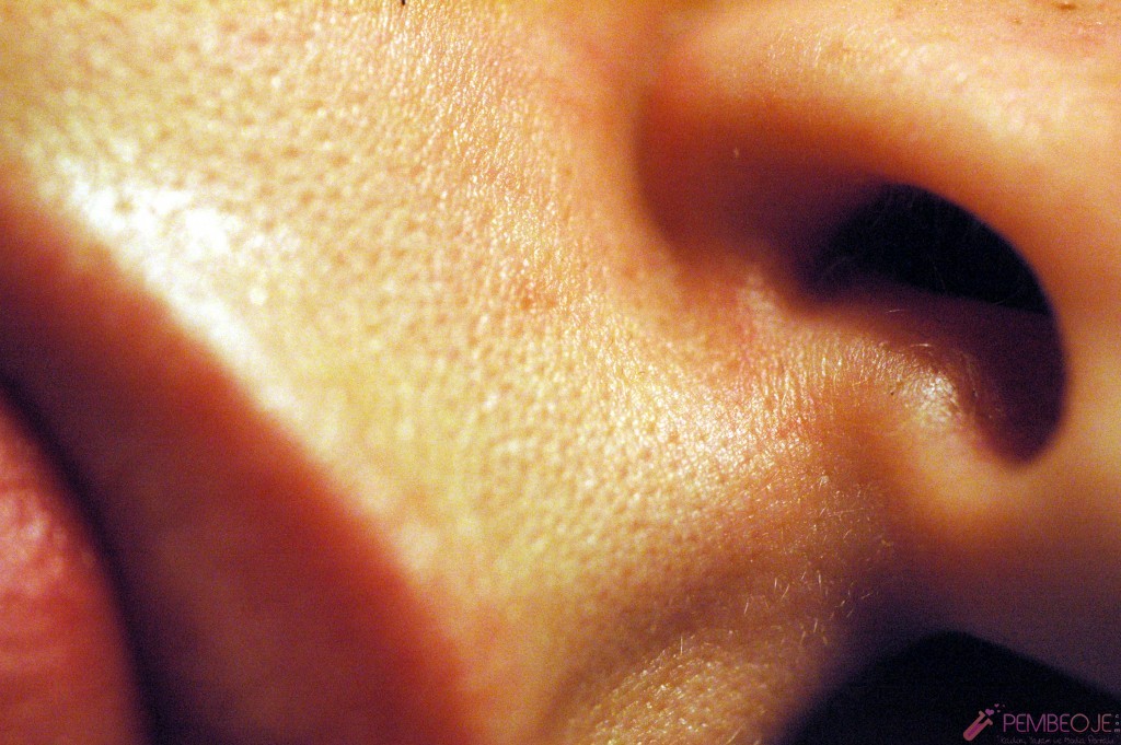 Burun Tıkanıklığı Ve Tedavisi