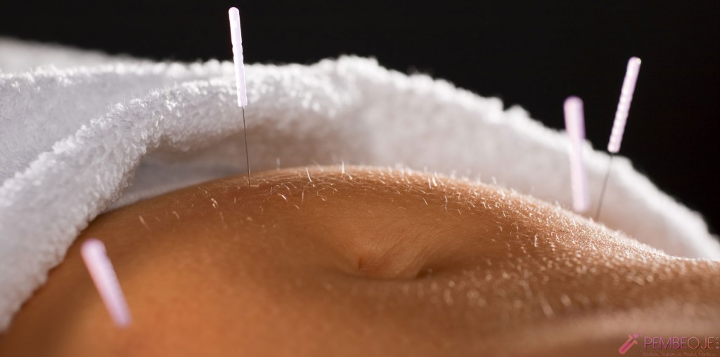 Akupunktur Bölgesel Zayıflama Öncesi ve Sonrası