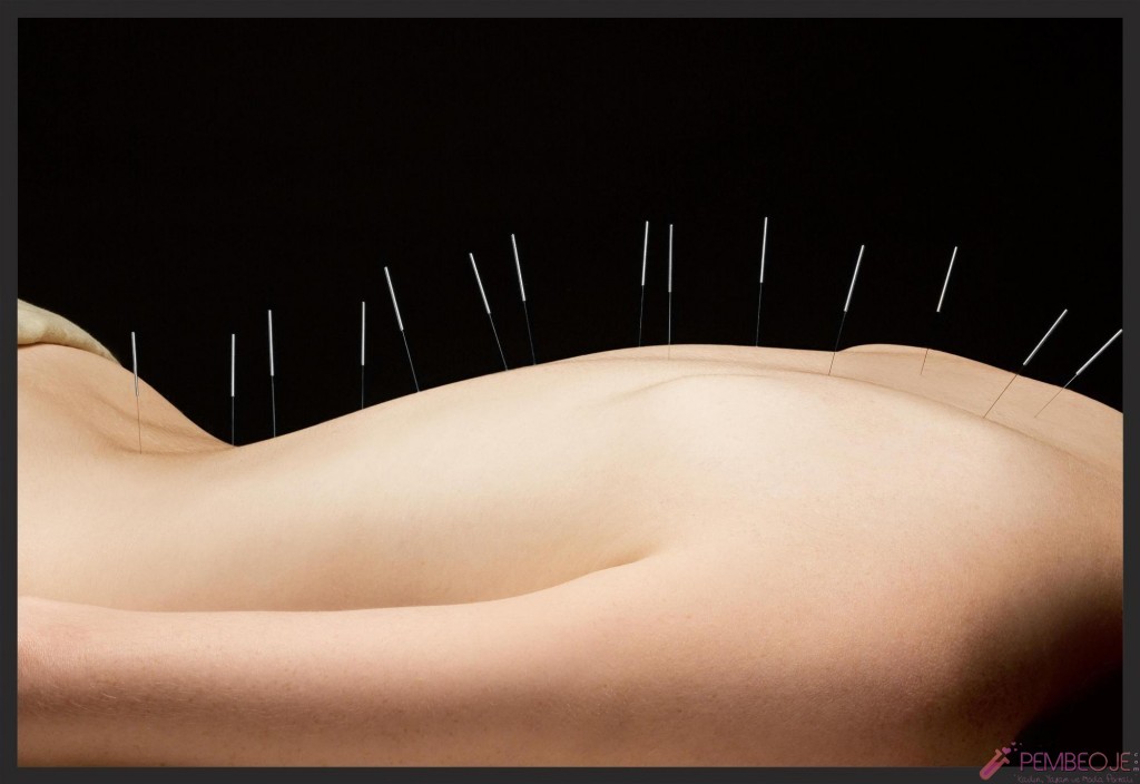 Akupunktur Zayıflama Öncesi ve Sonrası