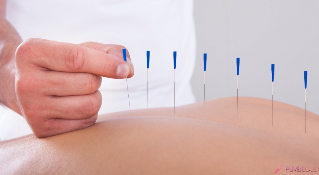 Akupunktur ile Bölgesel İncelme Yaptıranlar ve Yorumları