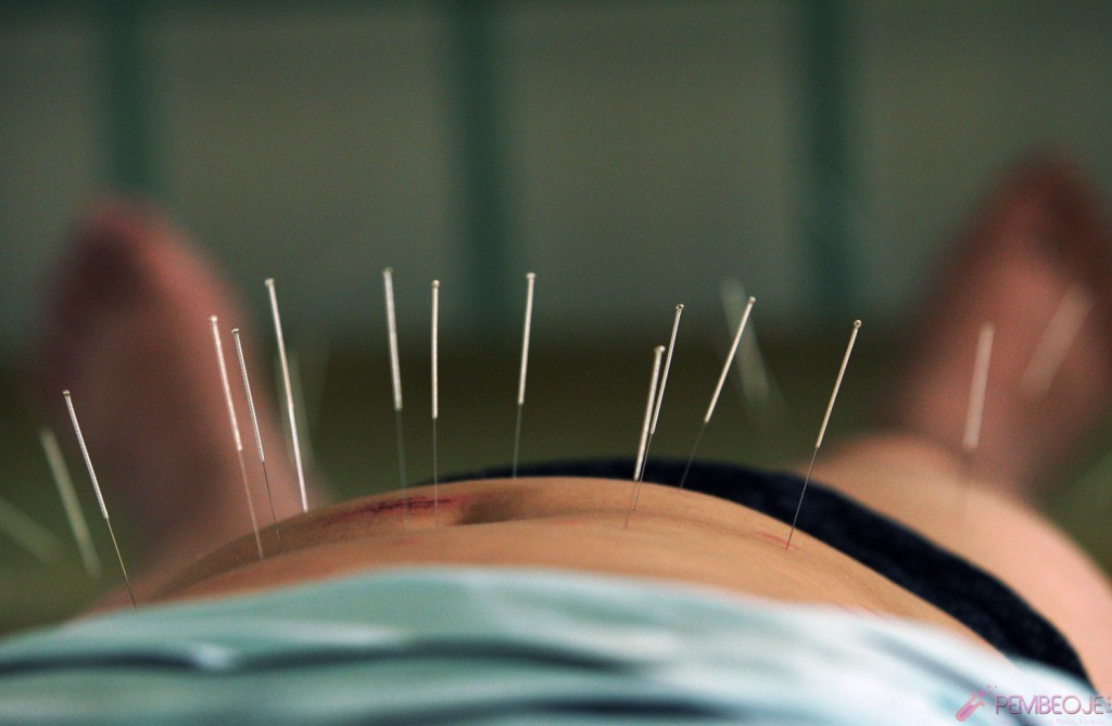 Akupunktur ile Bölgesel İncelme Öncesi ve Sonrası