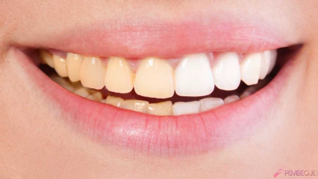 Beyaz ve parlak dişlere sahip olmanın doğal yolları