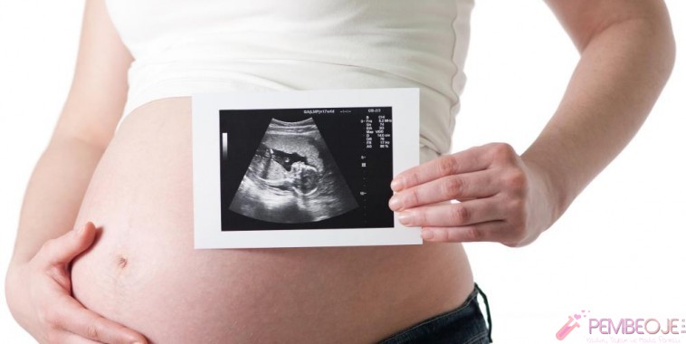 Как делают доплер. УЗИ допплерография при беременности. УЗИ С доплером при беременности. УЗИ беременности с допплерометрией. УЗДГ беременных (допплерометрия).